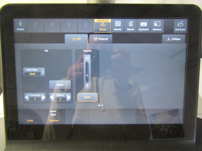 Philips EPIQ 7C (Cardiac) Ultrasound Machine for sale